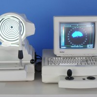 מיפוי ממוחשב (טופוגרפיה)של הקרנית חיוני לבדיקת תקינות פני הקרנית.