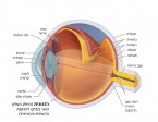 תמונה 1. הזגוגית תופסת את עיקר חלל העין.